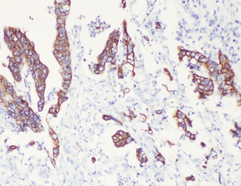 Cytokeratin 8/KRT8 Antibody