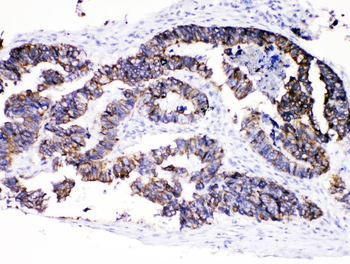 Cytokeratin 8/KRT8 Antibody