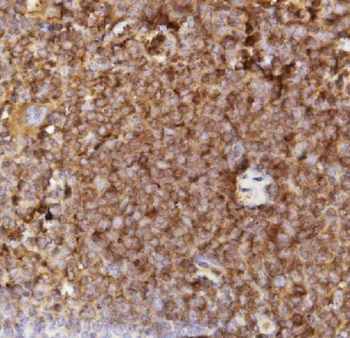 Sca1/Ly6A/E Rabbit Polyclonal Antibody