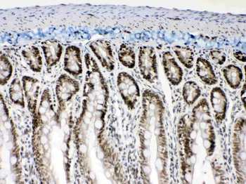 Musashi 1/Msi1 Antibody
