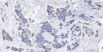 Musashi 1/Msi1 Antibody