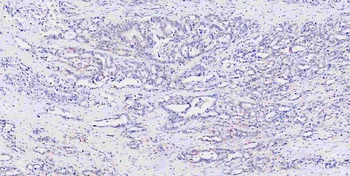 Musashi 1/Msi1 Antibody