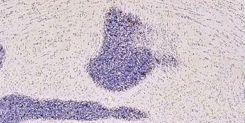 Musashi 1/Msi1 Antibody