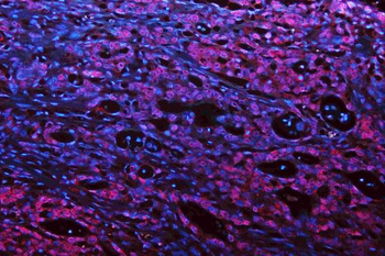 Musashi 1/Msi1 Antibody