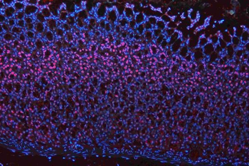 Musashi 1/Msi1 Antibody