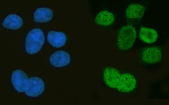 Musashi 1/Msi1 Antibody