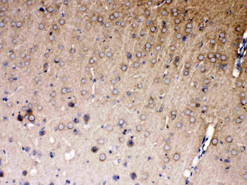 NDRG3 Rabbit Polyclonal Antibody