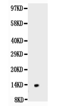 NGF/NGF Beta Rabbit Polyclonal Antibody
