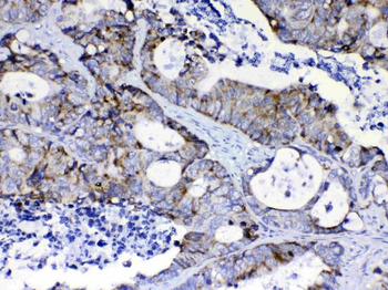 PI3 Kinase p110 beta/PIK3CB Rabbit Polyclonal Antibody