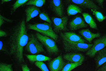 Cyclophilin A/PPIA Antibody