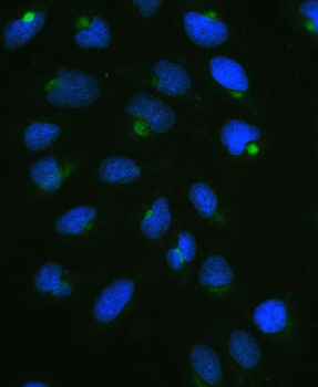 CPI17 alpha/PPP1R14A Antibody