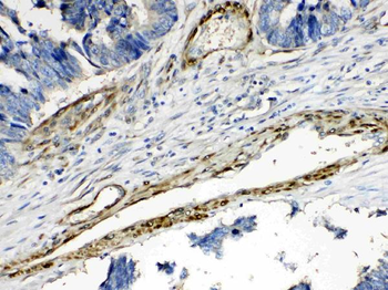 CPI17 alpha/PPP1R14A Antibody