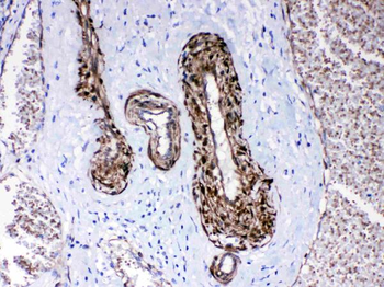CPI17 alpha/PPP1R14A Antibody