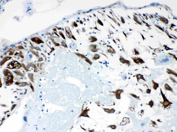 CPI17 alpha/PPP1R14A Antibody