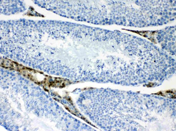 CPI17 alpha/PPP1R14A Antibody