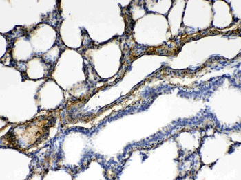 CPI17 alpha/PPP1R14A Antibody