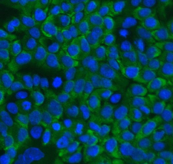 RanBP1 Rabbit Polyclonal Antibody