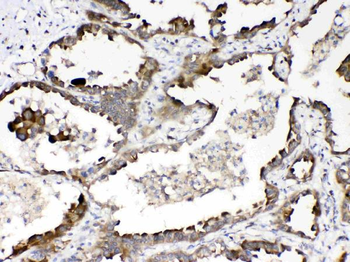 RanBP1 Rabbit Polyclonal Antibody