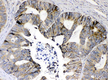 RPS6 Rabbit Polyclonal Antibody