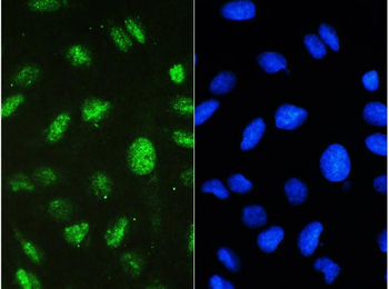 STAT1 Antibody
