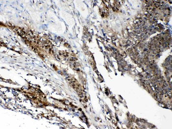 STAT1 Antibody