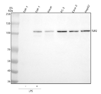 TLR2 Rabbit Polyclonal Antibody