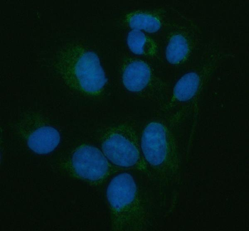 Pancreatic Lipase/PNLIP Rabbit Polyclonal Antibody