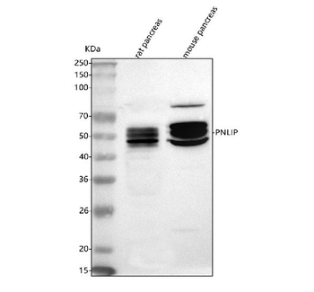 Pancreatic Lipase/PNLIP Rabbit Polyclonal Antibody