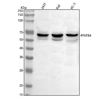 PFKFB4 Rabbit Polyclonal Antibody