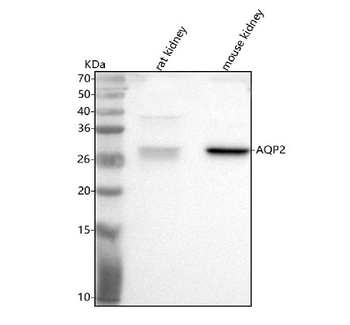 Aqp2 Rabbit Polyclonal Antibody