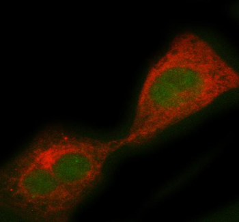 PCBD1 Rabbit Polyclonal Antibody
