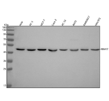 RBM17 Rabbit Polyclonal Antibody