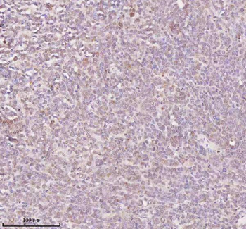 ORC2 Antibody