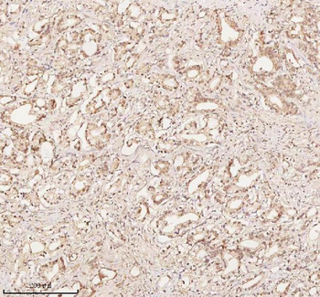 ORC2 Antibody
