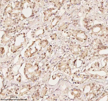 ORC2 Antibody