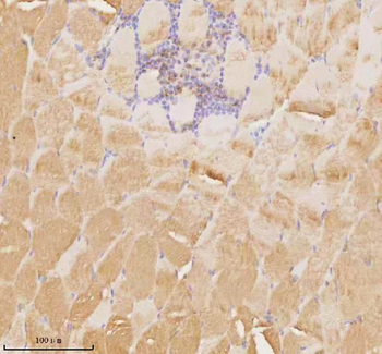 MAP4K3 Rabbit Polyclonal Antibody