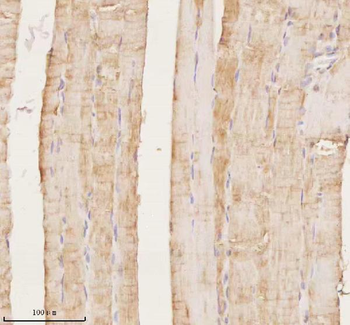 MAP4K3 Rabbit Polyclonal Antibody