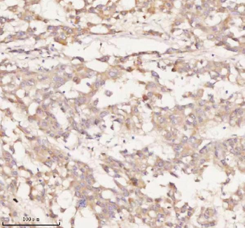 NUP43 Antibody