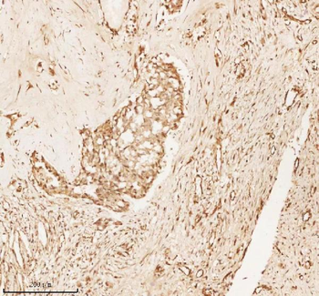 NUP43 Antibody