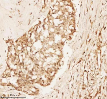 NUP43 Antibody