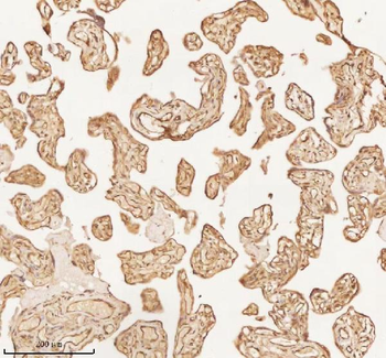 NUP43 Antibody