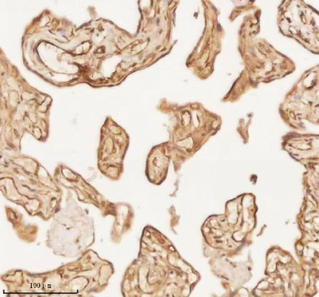 NUP43 Antibody