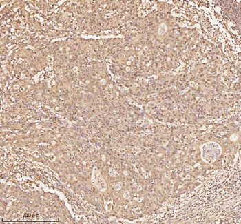 NUP43 Antibody