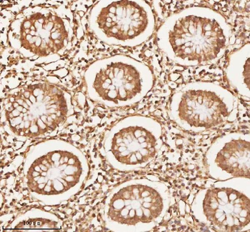 NUP43 Antibody
