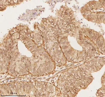 NUP43 Antibody