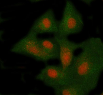 NSMCE4A Rabbit Polyclonal Antibody