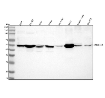NSMCE4A Rabbit Polyclonal Antibody