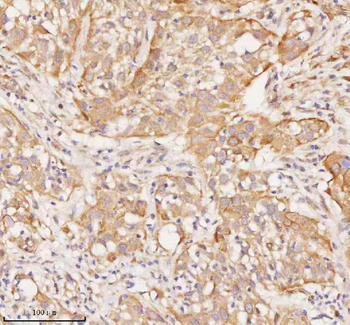 RNF25 Antibody