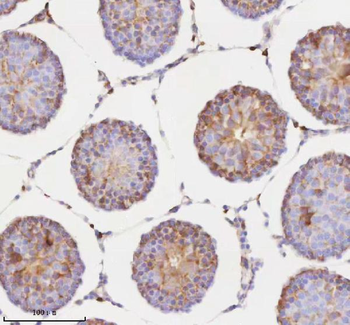 RNF25 Antibody