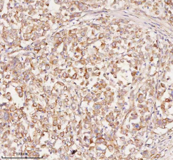 RNF25 Antibody